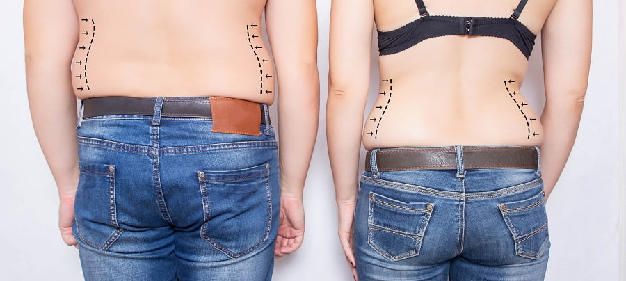 Couples facing fat in body issue | Dr. Leonard Grossman M.D. | New York