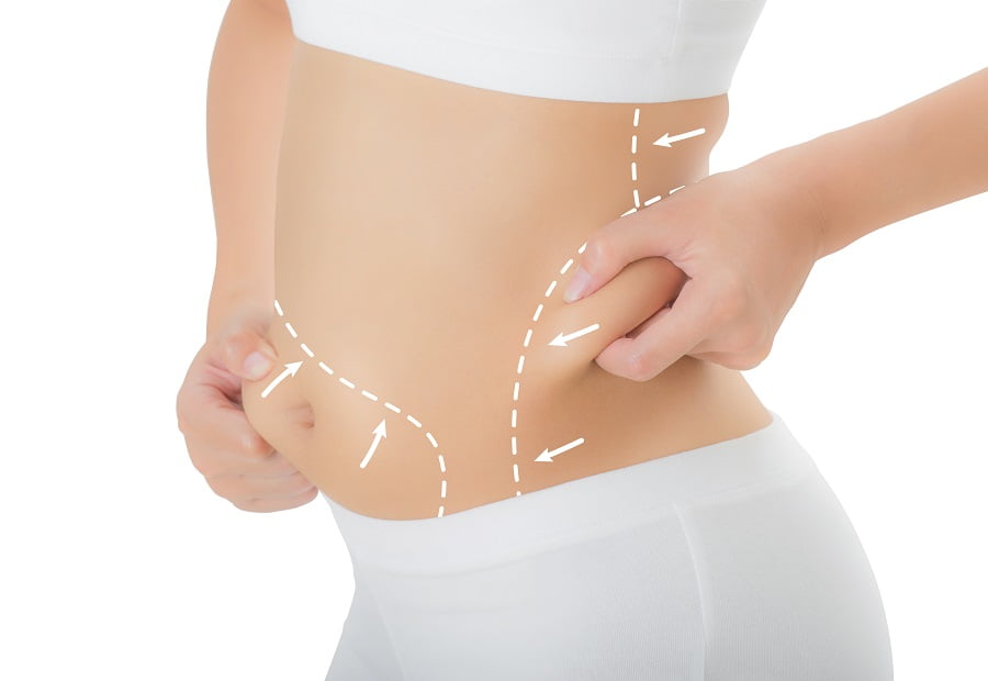 Liposuction | Dr. Leonard Grossman M.D. | NY