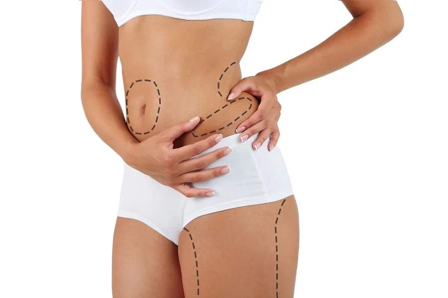 Liposuction vs. Microcannula Tumescent Liposuction: What's the