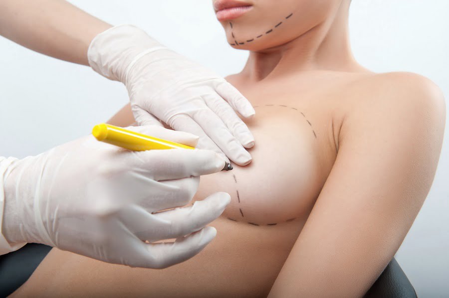 Breast Augmentation | Dr. Leonard Grossman M.D. | NY