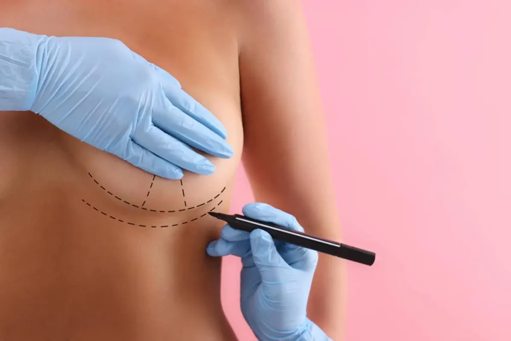 Breast Augmentation by Dr. Leonard Grossman in Brooklyn NY