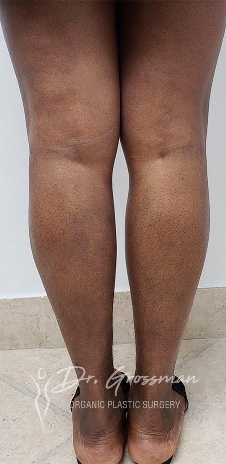 Girls showing her legs | New York City Plastic Surgery PC