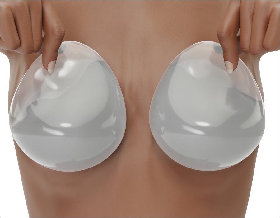 BREAST AUGMENTATION | Dr. Leonard Grossman M.D. | NY