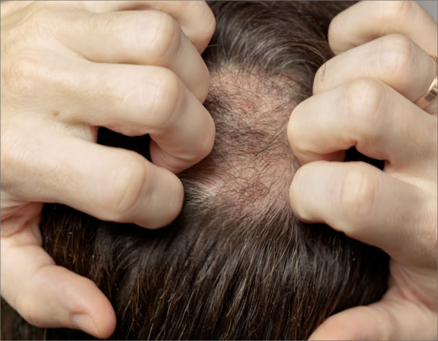 Hair Restoration | Dr. Leonard Grossman M.D. | NY