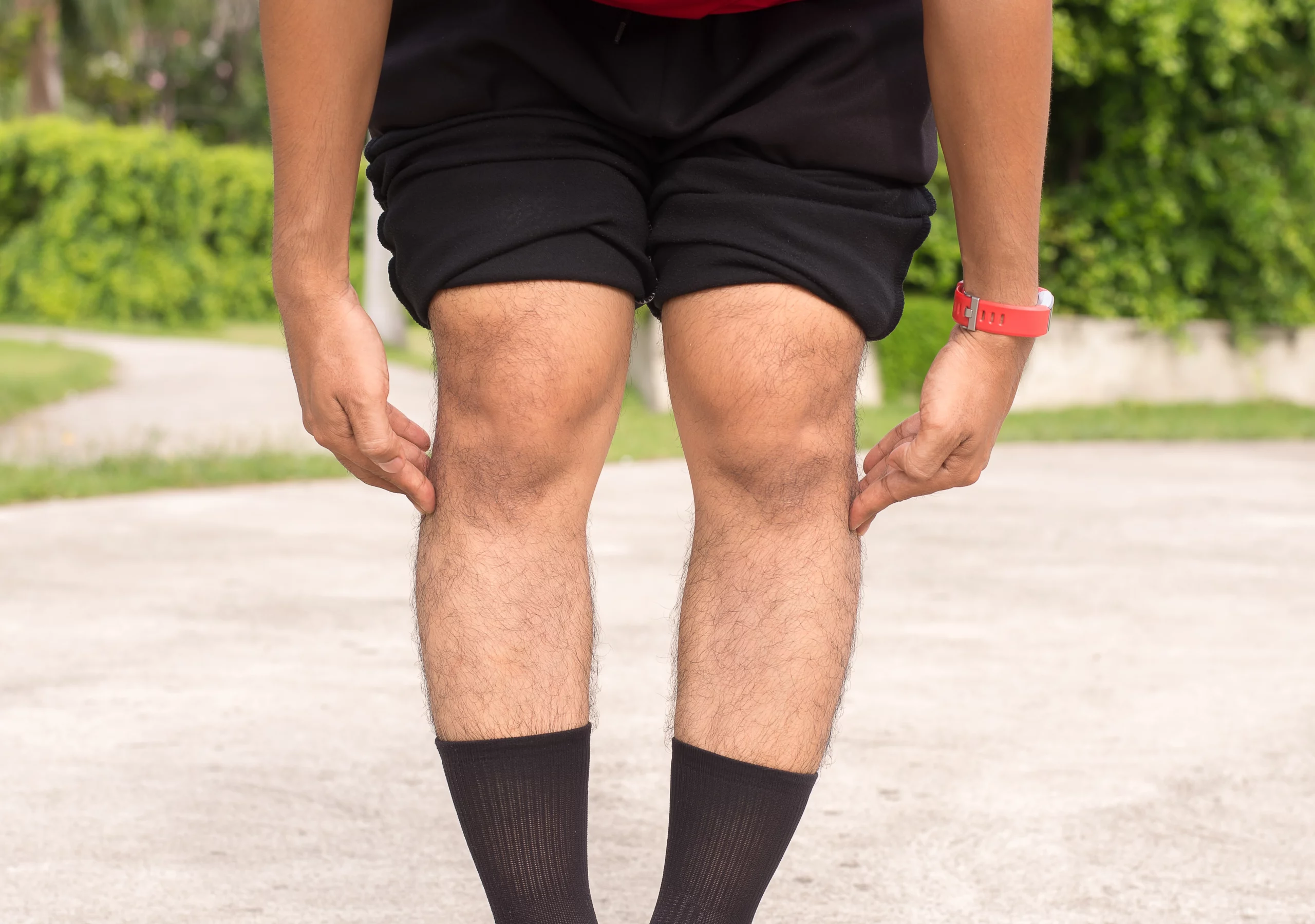 Bowed leg Surgery | drgrossman | Newyork