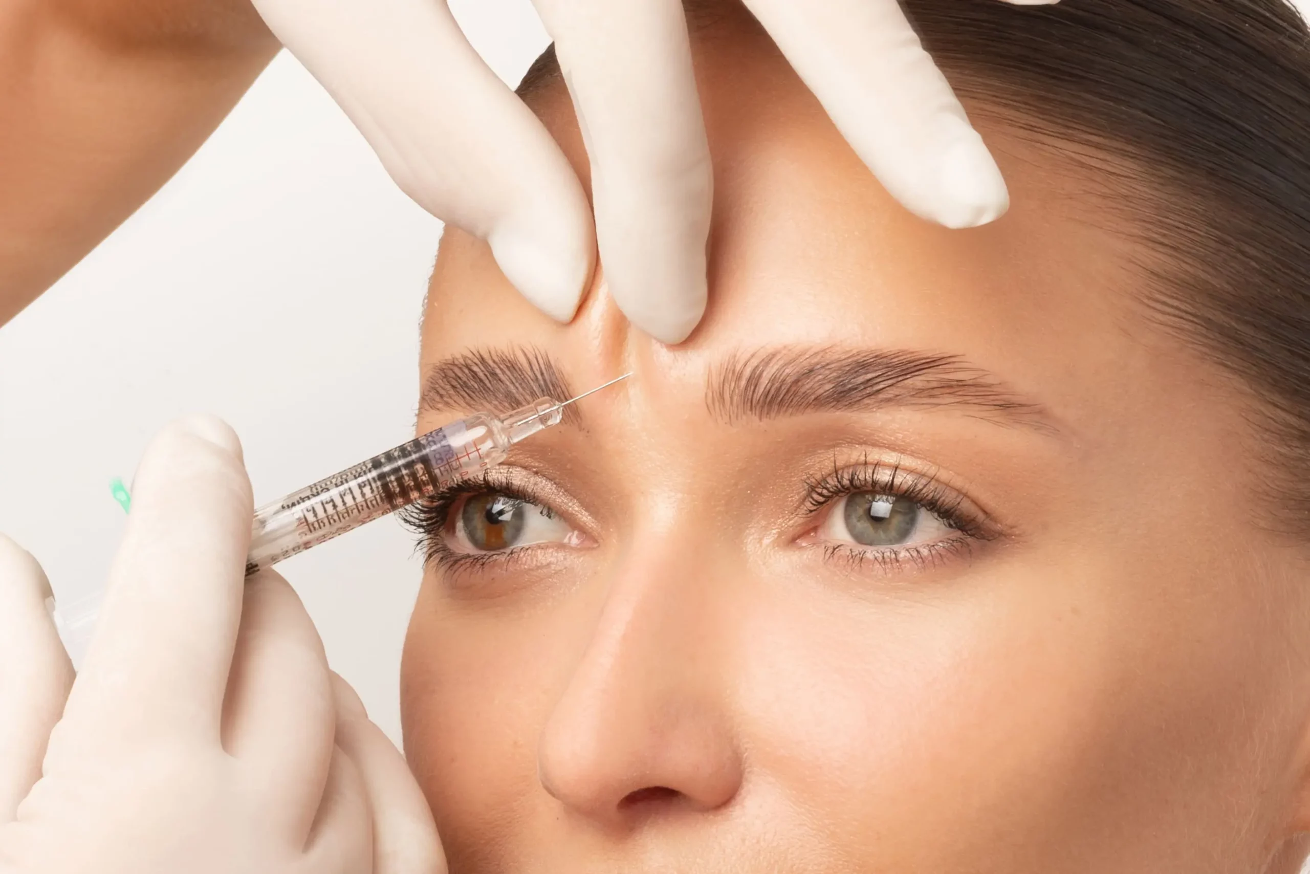 Restylane Injections