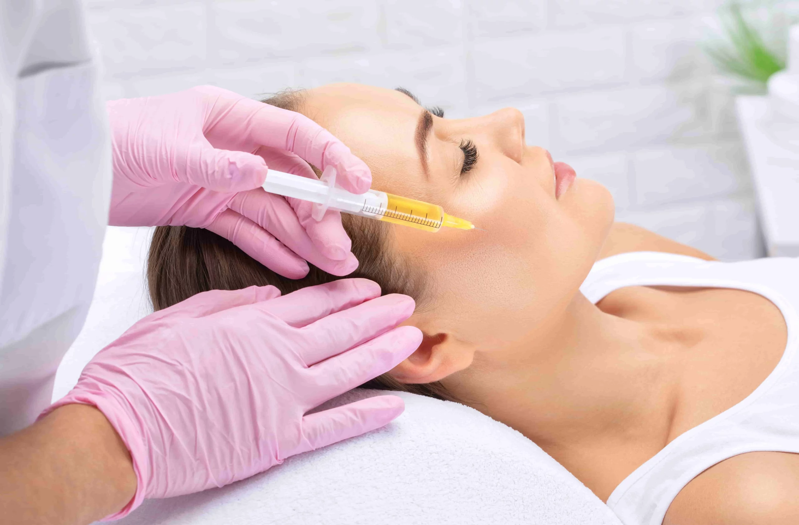 Sculptra Stimulates Collagen