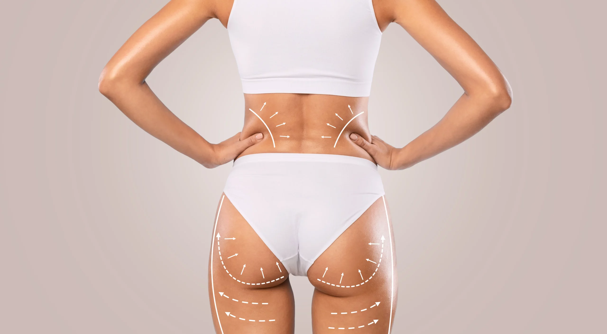Recovery Timeline and Expectations for Brazilian Butt Lift by Dr. Leonard Grossman